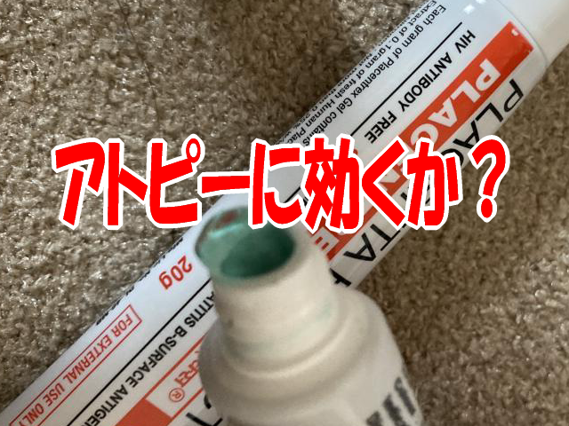 ヒトプラセンタジェルはアトピーに効くか